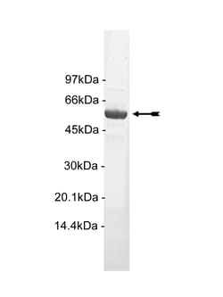 Eurofins DiscoverX Akt1/PKB ( PH, S473D) Protein, Active 10 &mu;g | Buy Online | Eurofins DiscoverX | Fisher Scientific